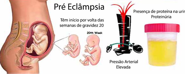 Sintomas Pre Eclampsia Inspire Sa De